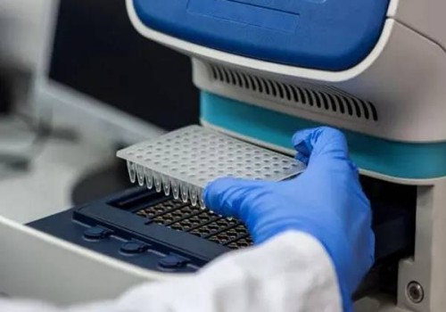 达到这四个条件的女性可以选择顺产，对身体伤害更小