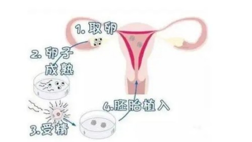 取卵后不能碰冷水吗？要注意些什么