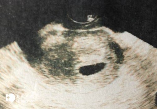 石家庄供卵：有助于怀孕的中药：这三大中药能够帮你快速受孕