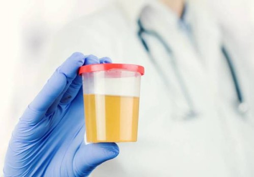 石家庄助孕机构：怎样从检查中判断胎儿是否患有地中海贫血？