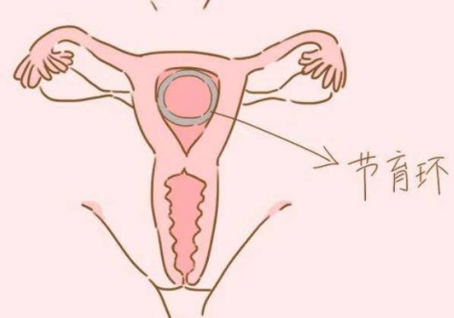 2022年石家庄试管婴儿政策最新解读：医保报销也有条件